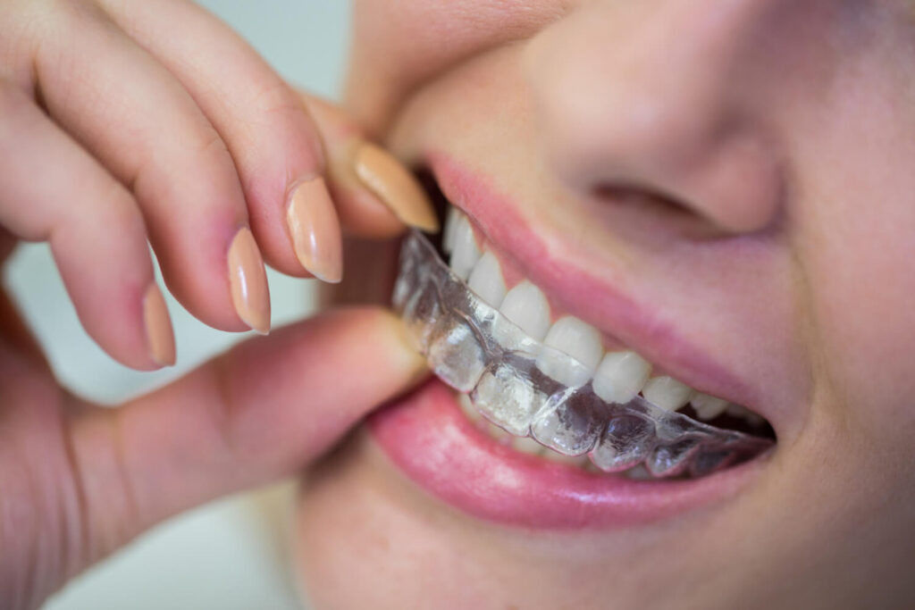 Ortodontia Aparelho Dental Sergipe